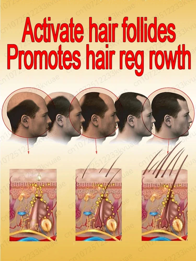 Best-selling hair oil, accelerates hair root growth, no longer worry about baldness, fast hair growth agent for men