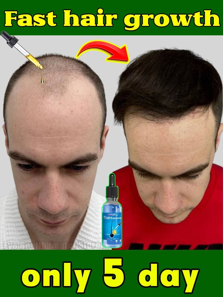 Best-selling hair oil, accelerates hair root growth, no longer worry about baldness, fast hair growth agent for men