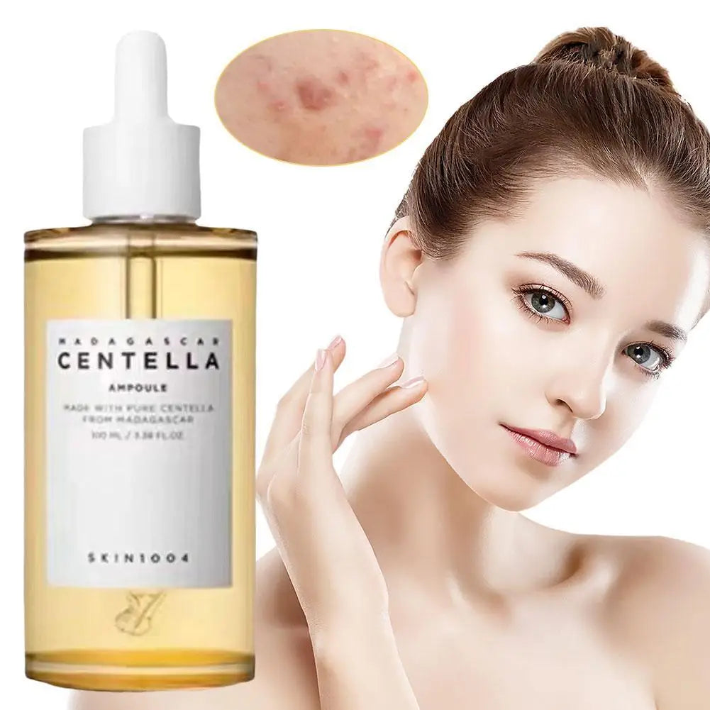 Centella Toner Bottle Centella Asian Facial Ampoule Oil Control Remove Acne,Moisturize Face Care Lotion Firming Wrinkles Liquid